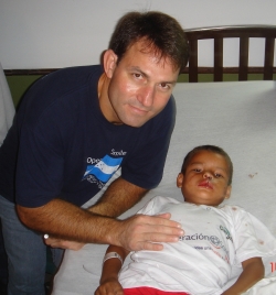 Dr. Paul Gardner and a young patient from Paraguay with repaired cleft lip